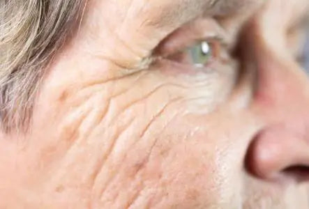 Compounded-Fluorouracil-and-Calcipotriol-Cream| Skin Plus Compounding Pharmacy